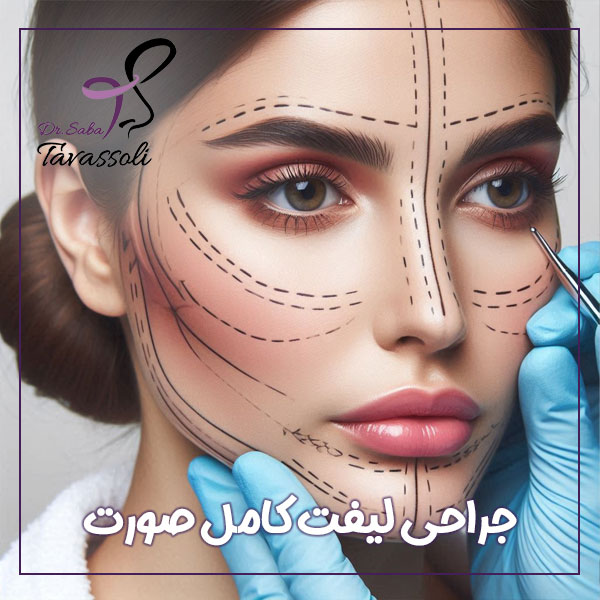 جراحی لیفت کامل صورت + دکتر صبا توسلی