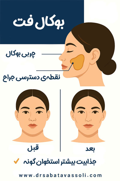 بوکال فت در بابل + دکتر صبا توسلی