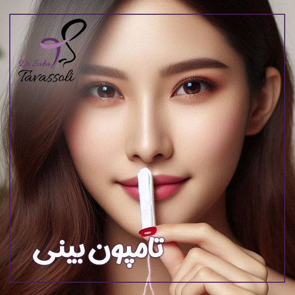 تامپون بینی + دکتر صبا توسلی