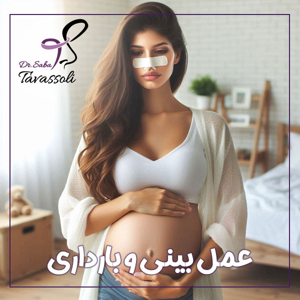 عمل بینی و بارداری + دکتر صبا توسلی