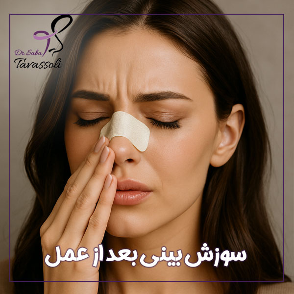 سوزش بینی بعد از عمل + دکتر صبا توسلی
