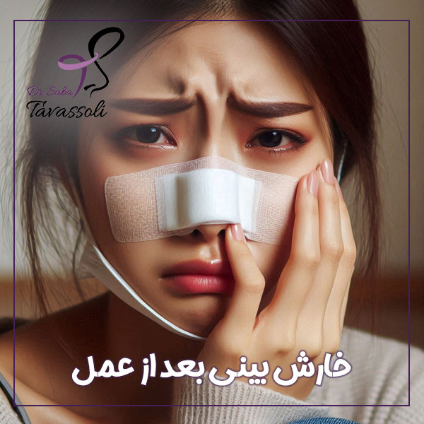 خارش بینی بعد از عمل + دکتر صبا توسلی