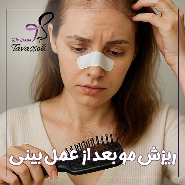 ریزش مو بعد از عمل بینی + دکتر صبا توسلی