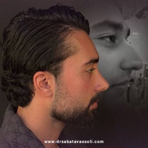 Rhinoplasty-28