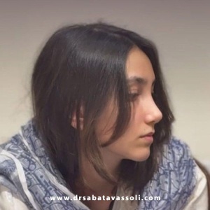 Rhinoplasty-33
