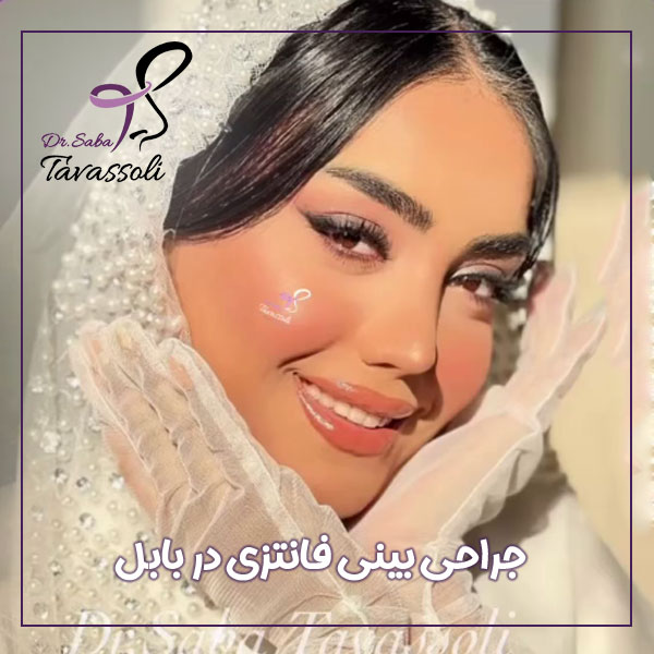 جراحی بینی فانتزی در بابل + دکتر صبا توسلی