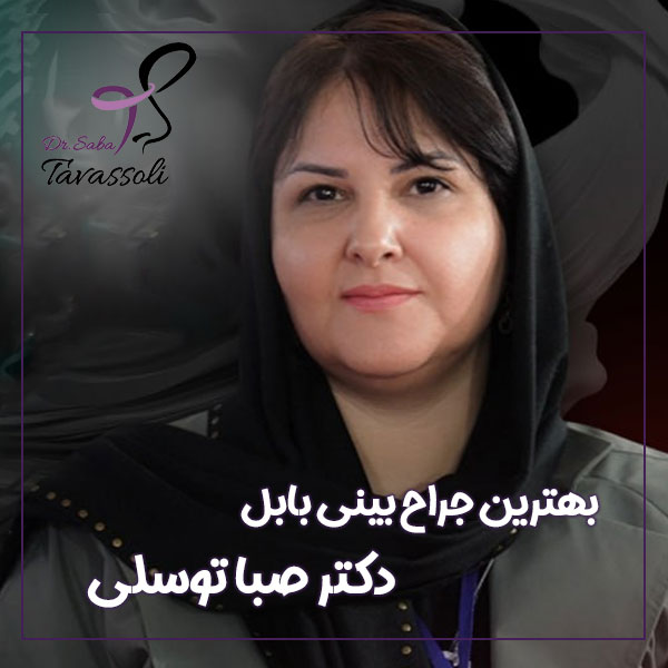 بهترین جراح بینی بابل + دکتر صبا توسلی