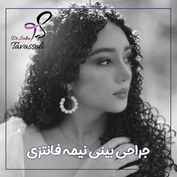 جراحی بینی نیمه فانتزی در بابل + دکتر صبا توسلی