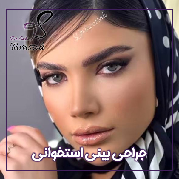 جراحی بینی استخوانی در بابل + دکتر صبا توسلی