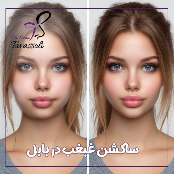 جراحی ساکشن غبغب در بابل + دکتر صبا توسلی