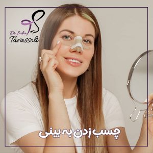 چسب بینی + دکتر صبا توسلی