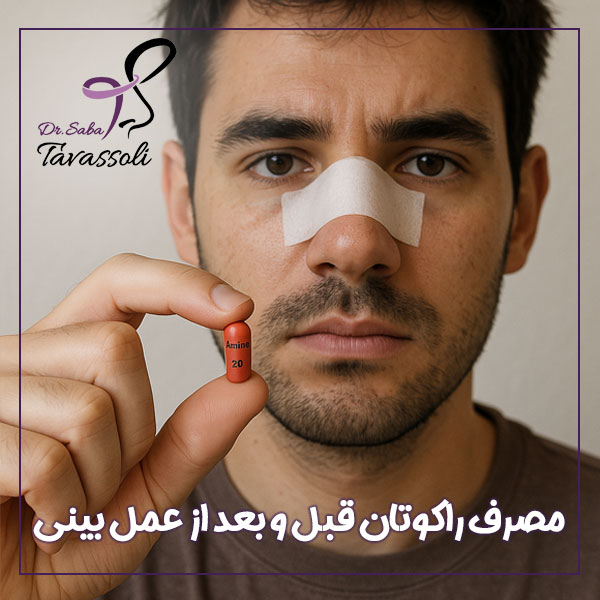 مصرف راکوتان قبل و بعد از عمل بینی + دکتر داریوش محمدی