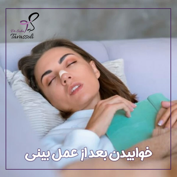 خوابیدن بعد از عمل بینی + دکتر صبا توسلی