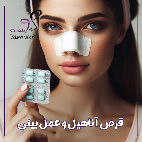قرص آناهیل و عمل بینی + دکتر صبا توسلی