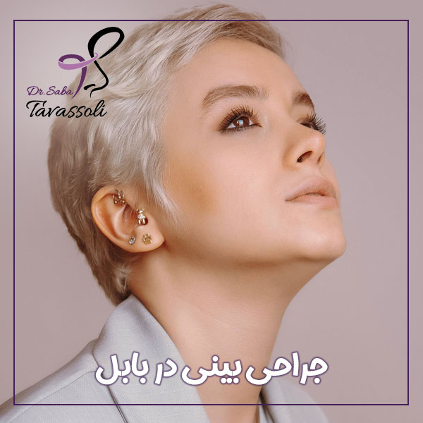 جراحی بینی در بابل + دکتر صبا توسلی