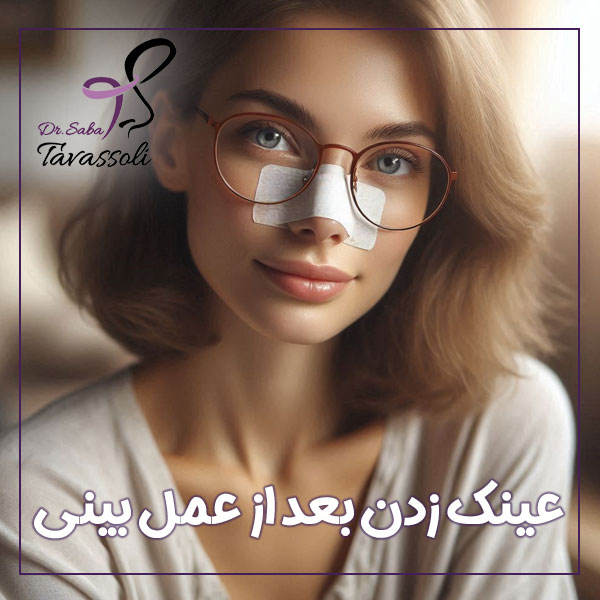 عینک زدن بعد از عمل بینی | دکتر صبا توسلی