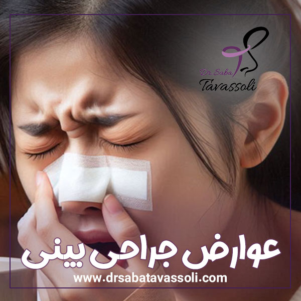 عوارض جراحی بینی + دکتر صبا توسلی