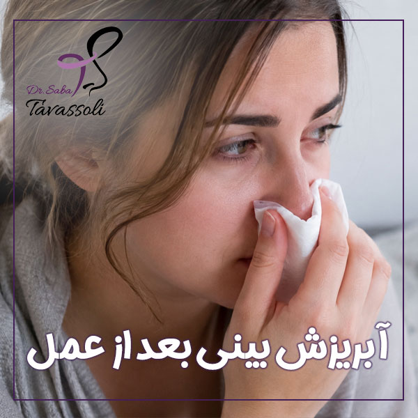 آبریزش بینی بعد از عمل + دکتر صبا توسلی