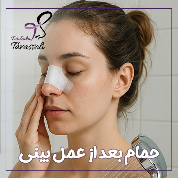 حمام بعد از عمل بینی + دکتر صبا توسلی